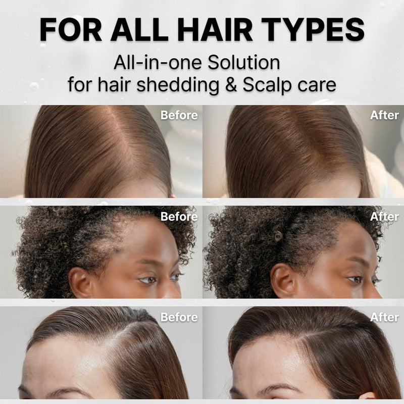 Natox Hair Growth Serum with Built in Brush for Hair Growth & Thickening