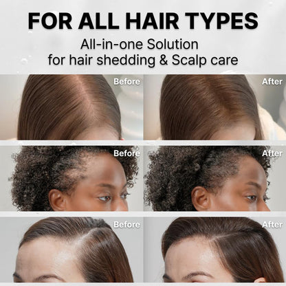 Natox Hair Growth Serum with Built in Brush for Hair Growth & Thickening